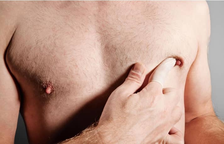 Cancer du sein Chez l&rsquo;homme : Une maladie rare mais dangereuse.